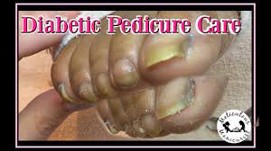 diabetic pedicure tutorial and foot