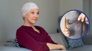 hair loss during cancer treatment