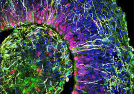 Human Cortical Organoids Model Neuronal Networks | The Scientist ...