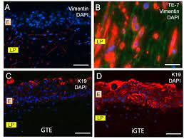 Epos | sennheiser gsx 1000 gaming audio amplifier / external sound card, with 7.1 surround sound, side tone, gaming dac and eq, headphone amp compatible with windows, mac, laptops and desktops. Expression Of Vimentin Te 7 And K19 In Gte Immunofluorescence Download Scientific Diagram