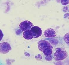 However, these cells may start behaving abnormally and form clusters/tumors, releasing huge amounts of chemicals into the kitty's body. Mastocytoma Wikipedia