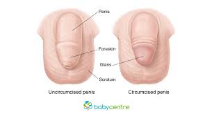 Circumcision In Baby Boys Babycentre Uk