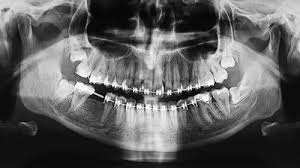 radiologie dentaire centre de