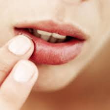 Image result for MODEL CHAPPED LIPS