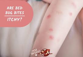 are bed bug bites itchy symptoms