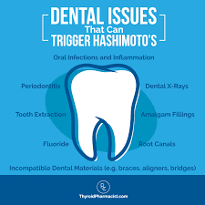can dental issues cause hashimoto s