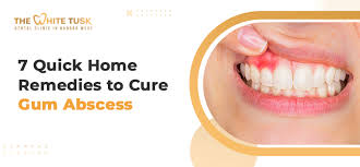 home remes to cure gum abscess