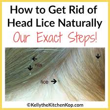 how to get rid of head lice naturally