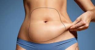 does coolsculpting work