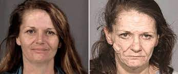 Ask the meth project to get your questions answered with straight facts about meth and true stories. Before And After Stories Pictures Of Methamphetamine Addiction