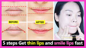 get thin lips and smile lips