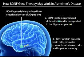 Alzheimer's is the sixth leading cause of death in the united states. Clinical Trial Begins For Gene Therapy To Treat Alzheimer S Disease