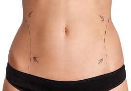 areas of the body that simple lifestyle changes just can t change if you re ready to turn to cosmetic surgery then consider how getting liposuction in