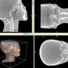 cone beam ct allows for greater