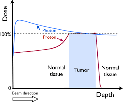 radiation therapy for prostate cancer