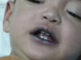 pediatric pearls infant s skin part 1