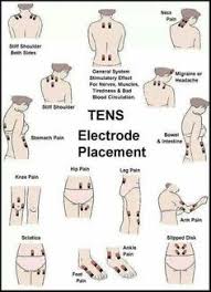 Image Result For Ems Electrode Placement Chart To Build