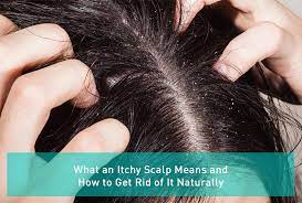 what an itchy scalp means and how to