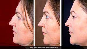 get rid of double chin yoga to