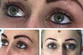 semi permanent eyebrow removal in leeds