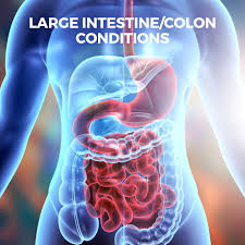 large intestine colon conditions