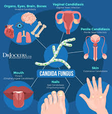 toenail fungus symptoms causes and