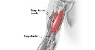 biceps tendonitis at the elbow