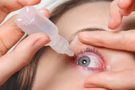 dry eyes after lasik