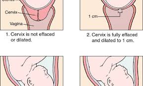 Cervix Dilation Diagram Cervix Dilation Chart Actual Size