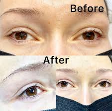 permanent eyeliner before after