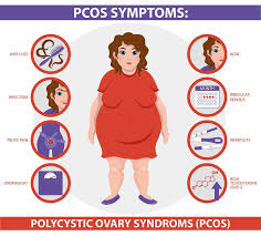 the histamine pcos connection dr