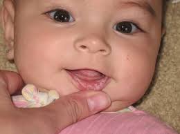 Ulser mulut merupakan salah satu masalah yang sering dihadapi rakyat malaysia. Lidah Bayi Putih Ini 5 Perkara Yang Anda Patut Buat
