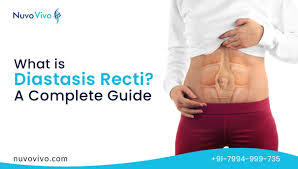 what is diastasis recti causes