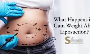 gain weight after liposuction