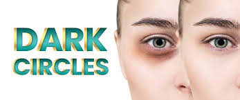 how to remove dark circles under eyes