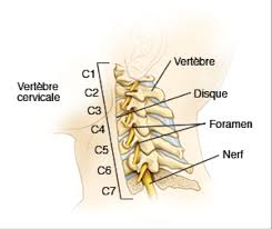 The cervical spine is made up of the first seven vertebrae in the spine. L Origine Des Douleurs Cervicales Et Comment En Finir Avec Le Mal De Cou
