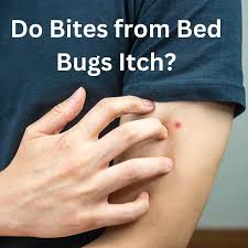 do bites from bed bugs itch what you
