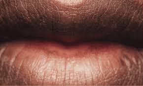 spiritual meaning of chapped lips