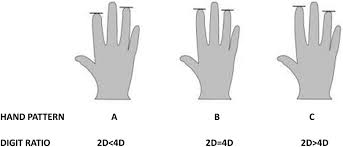 A Comparative Study On Digit Ratio And Hand Patterns Of