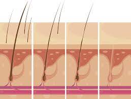 毛髪診断士監修】毛根鞘まで抜くと快感・・・。これって病気か毛を抜きたくなる癖？ | スカルプD コラム | スカルプD公式サイト | アンファー