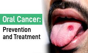 cancer prevention and treatment