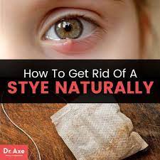 how to get rid of a stye follow these