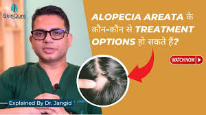 alopecia areata causes symptoms