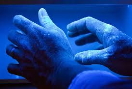 Effectiveness Of Uv Light Therapy For Psoriatic Arthritis