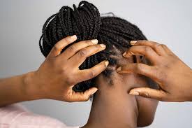 scalp atopic dermais vs other skin