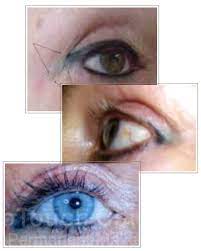 permanent eyeliner treatments