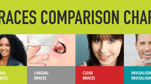 Braces Technology A Comprehensive Chart Fresh Orthodontics
