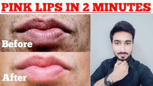 how to get pink lips naturally for boys