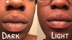 how to lighten dark black smoker lips