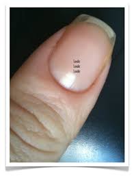 Maybe you would like to learn more about one of these? Clear Fingernails Is It A Bad Thing Nail Care Hq